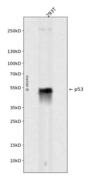 p53 (Phospho-Thr18) Antibody