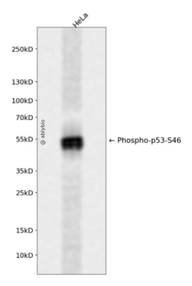 Phospho-p53 (Ser46) pAb