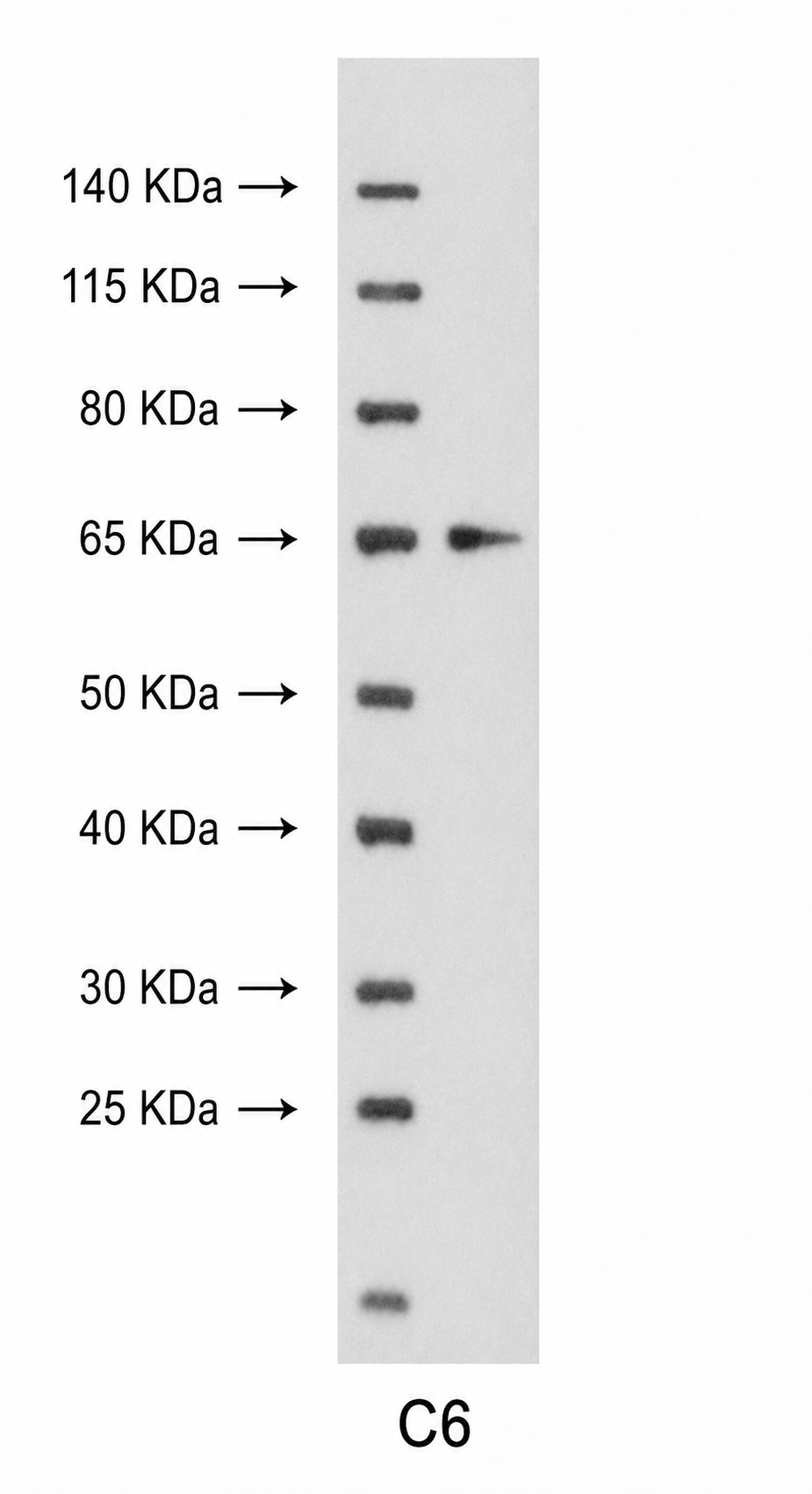 FoxO4  Rabbit mAb