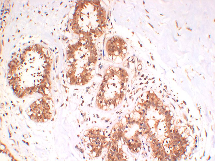 HSC70 Rabbit mAb