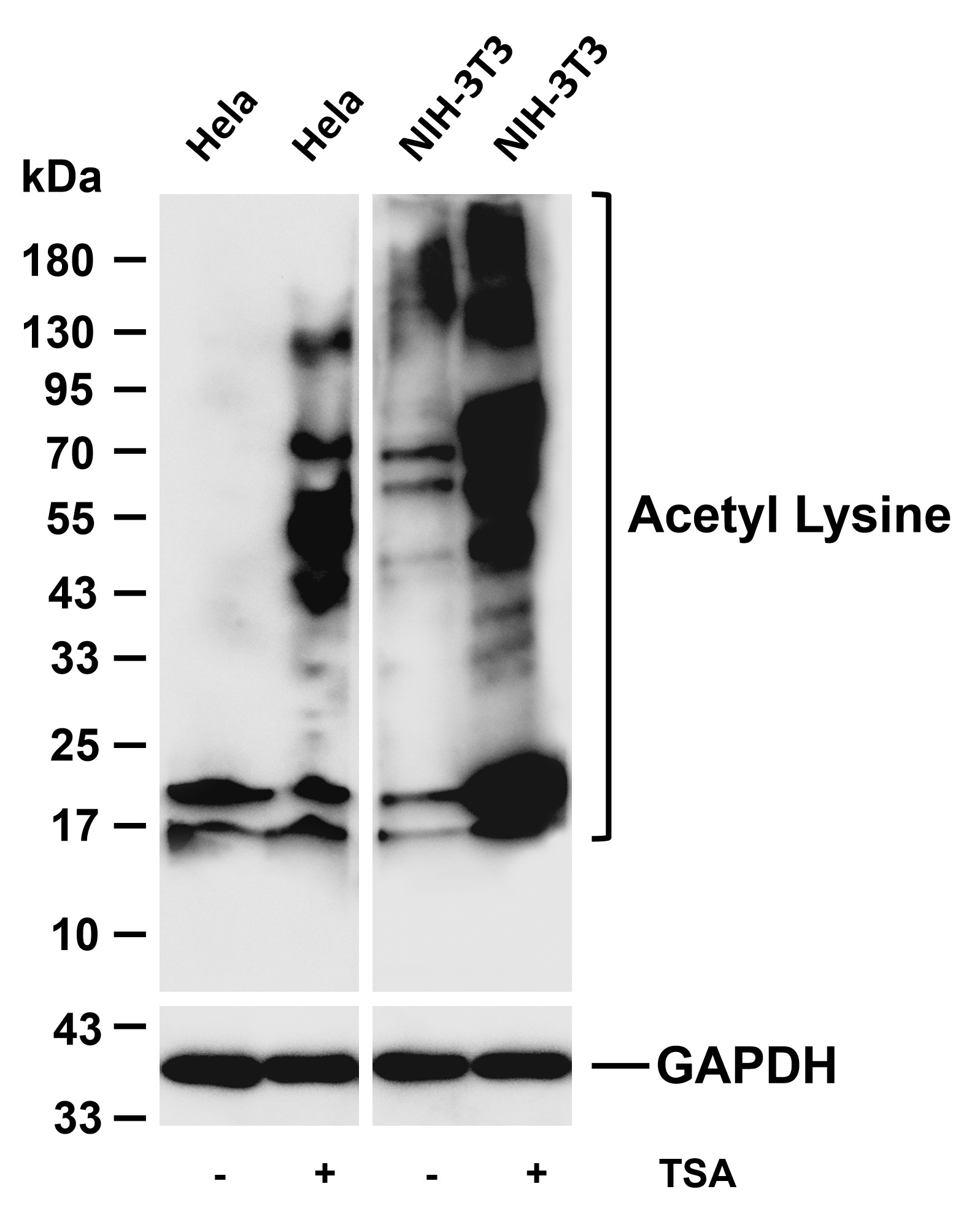 Acetyl Lysine  Rabbit mAb