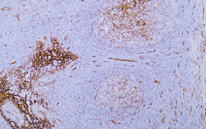 &beta; Catenin (ABT-Catenin) Mouse mAb