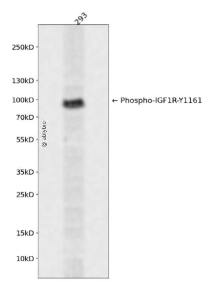Phospho-IGF1R/Insulin Receptor (Tyr1161/Tyr1185) pAb