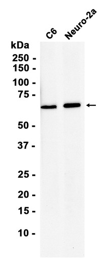 AMPK alpha 1 (YD12278) Rabbit mAb