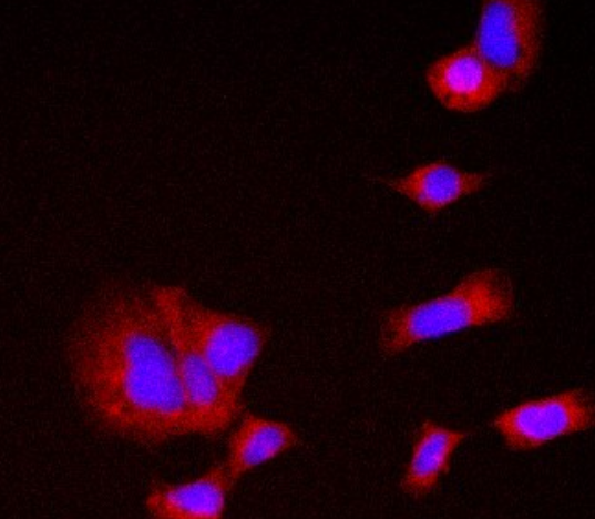 Phospho-TBC1D4 (Ser318) Antibody