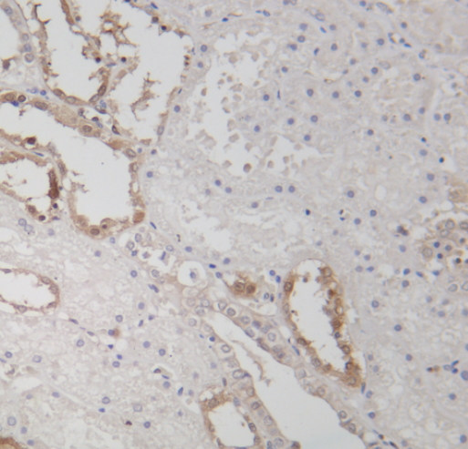 NQO1 Rabbit mAb