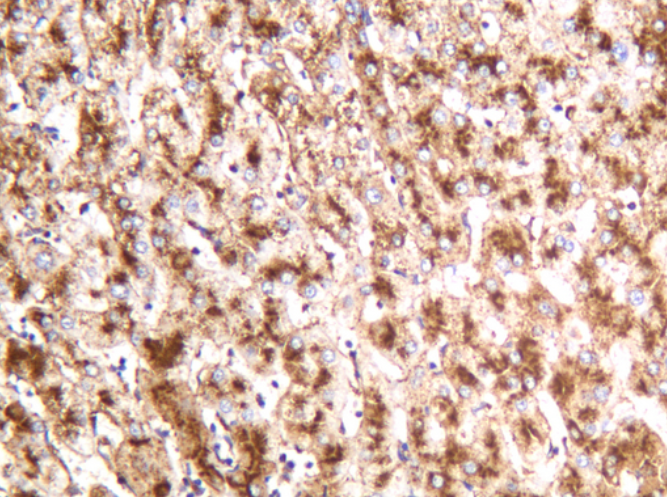 LAMP1 Rabbit mAb