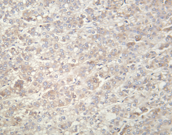 eIF2&alpha; (Phospho Ser51)  Rabbit mAb