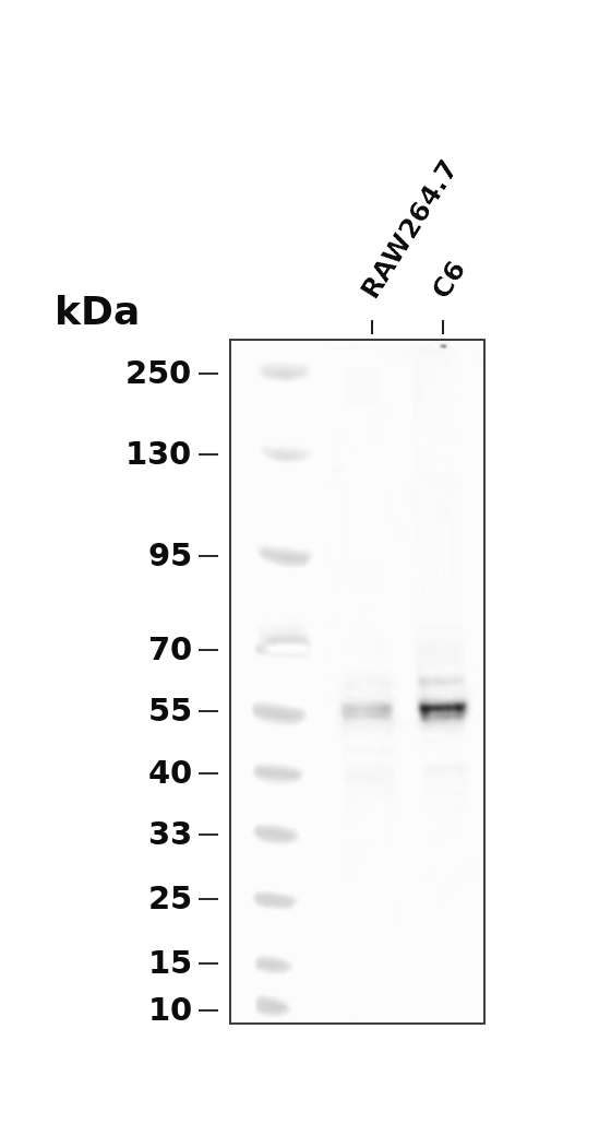 Phospho-CaMKII (Thr286) (YD19542) Rabbit mAb