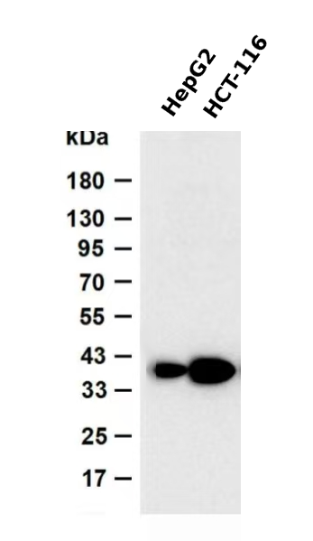Wnt5a (PT1566R)  Rabbit mAb