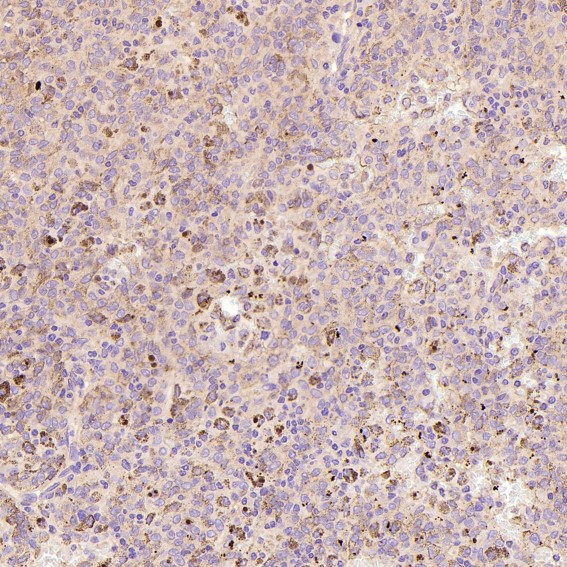 Phospho-ERK1/2 (Thr202/Thr185)