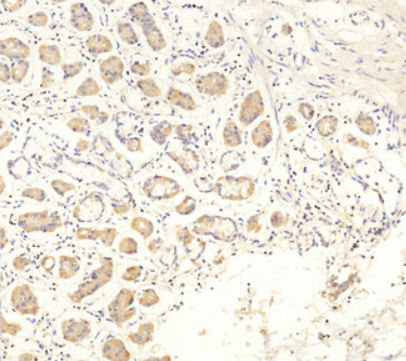 Collagen II Rabbit mAb