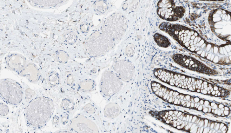 Syndecan 1 Rabbit mAb