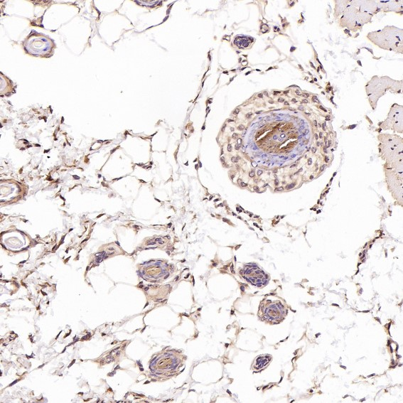 Phospho-ERK1/2 (Thr202+Tyr204/Thr185+Tyr187) pAb