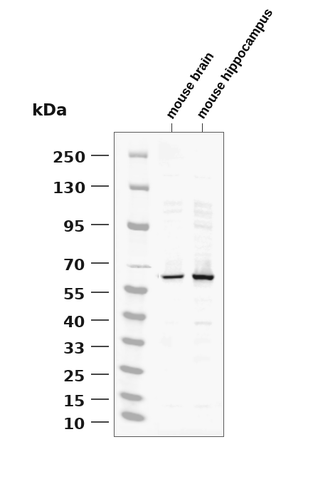 EAAT2 (YD14568) Rabbit mAb