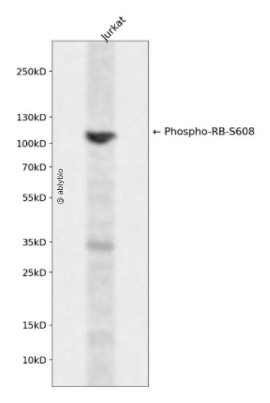 Phospho-Retinoblastoma (Ser608) pAb