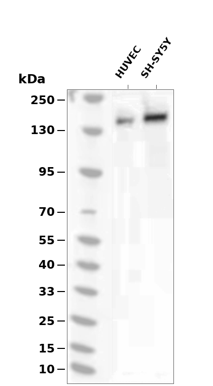 IGF1R/Insulin Receptor beta (Phospho-Thr1361) Antibody