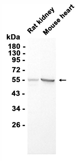 CYP17A1 Rabbit mAb