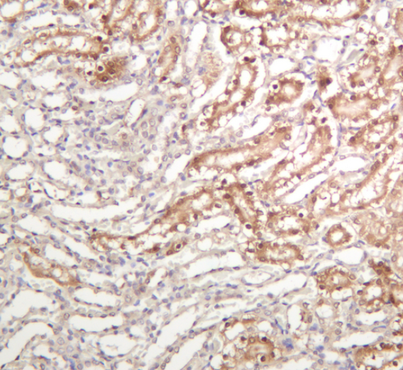 NQO1 Rabbit mAb