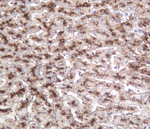 LAMP2 Rabbit mAb