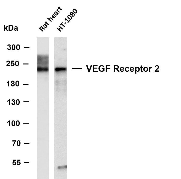 VEGF Receptor 2 Rabbit mAb