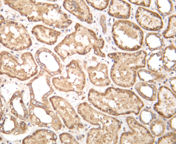 eIF2&alpha; Rabbit mAb