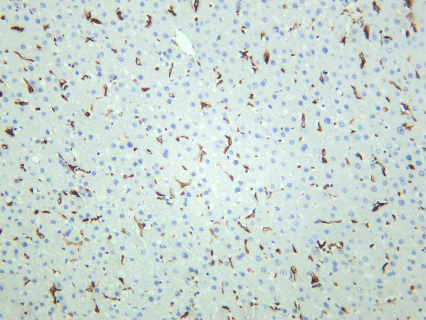CD163 Rabbit mAb