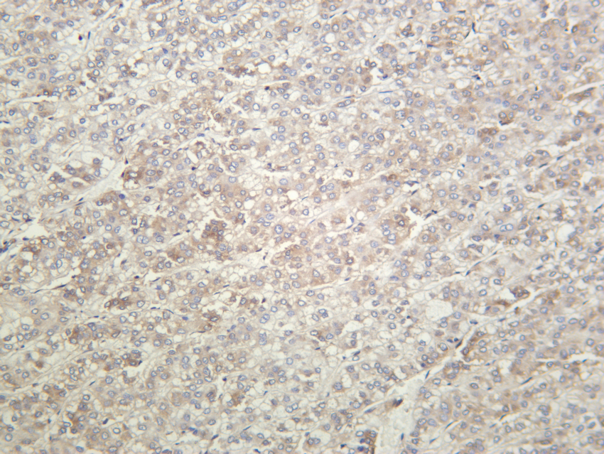 eIF2&alpha; (Phospho Ser51)
