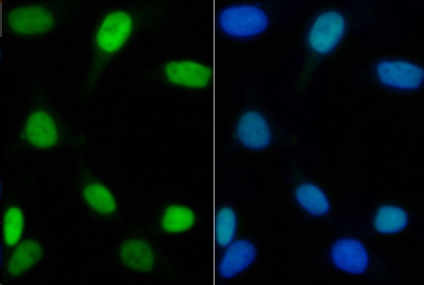 FRA1 (YD15087) Rabbit mAb