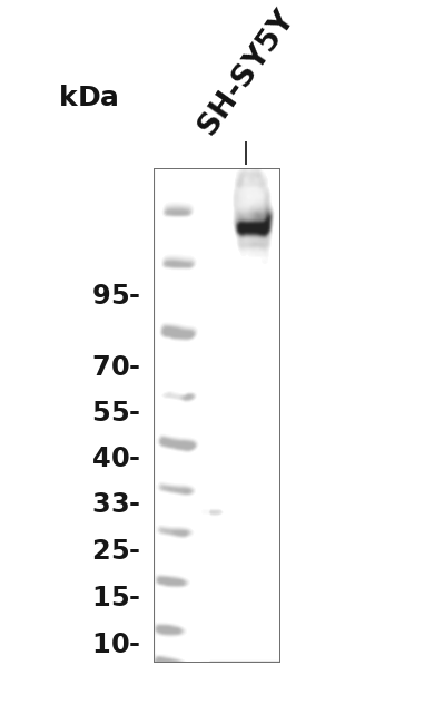 Phospho-PDGF Receptor beta (Tyr1021) (YD14960) Rabbit mAb
