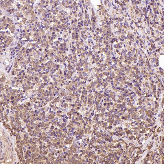 Hsp90 Rabbit mAb