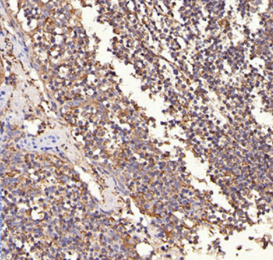 ErbB 2 (YD12025) Rabbit mAb