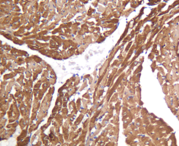 SERCA2 ATPase (YD32302) Rabbit mAb