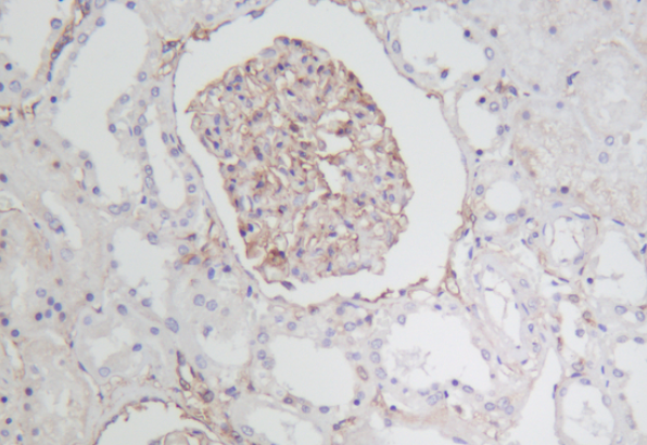 PDGFR-&beta; Rabbit mAb