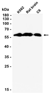 STIP1 (YD16230) Rabbit mAb