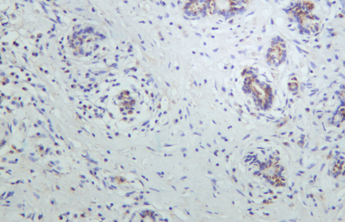Peroxiredoxin 1 Rabbit mAb