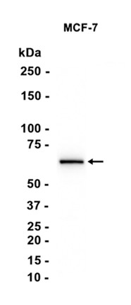 SQSTM1/p62