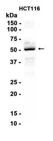 CaMKII alpha/beta/delta (Phospho-Thr305) Antibody