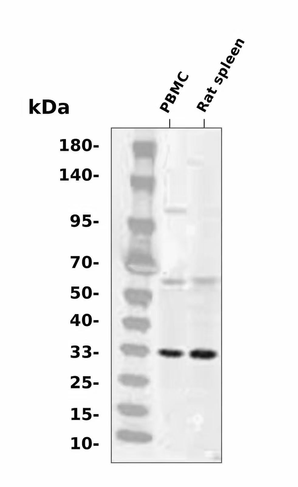 Granzyme B (YD20678) Rabbit mAb