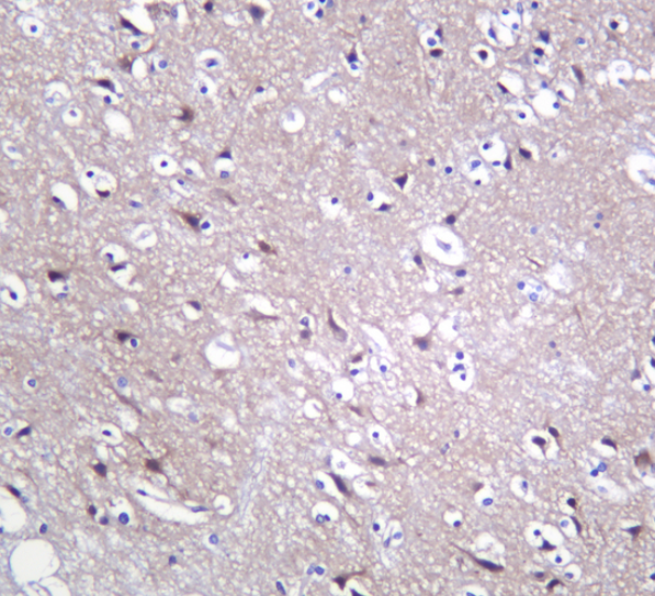 PDGF-B Rabbit mAb