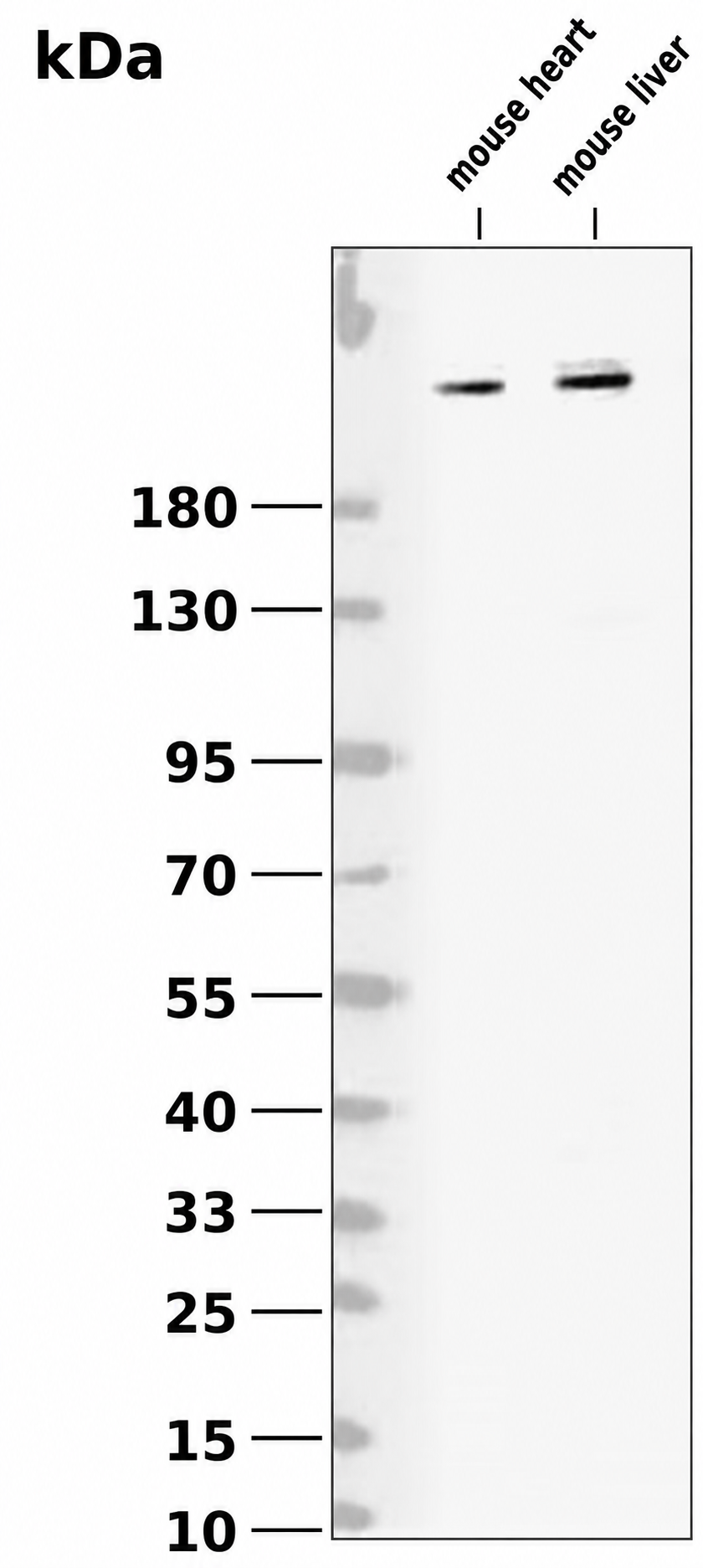 Flk-1/VEGFR2 (Phospho Tyr1175)  Rabbit mAb