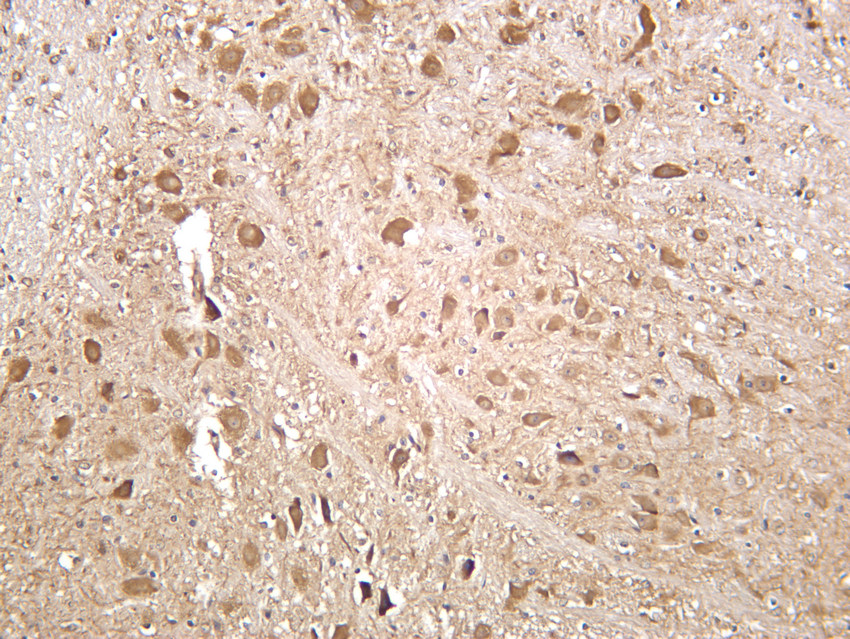 CaMKII &alpha; Rabbit mAb