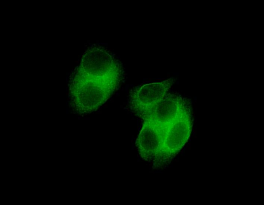 CD206/MRC1 Rabbit mAb