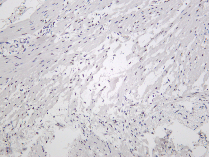 AREB6 Rabbit mAb