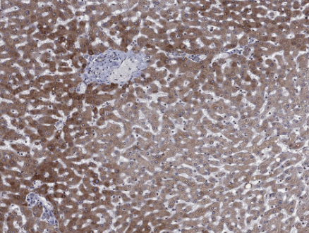 SMC3 Rabbit mAb