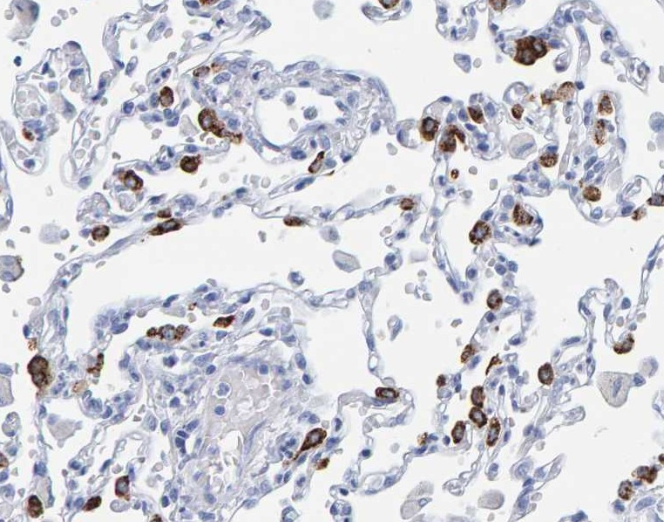 SP-C (YD18418) Rabbit mAb
