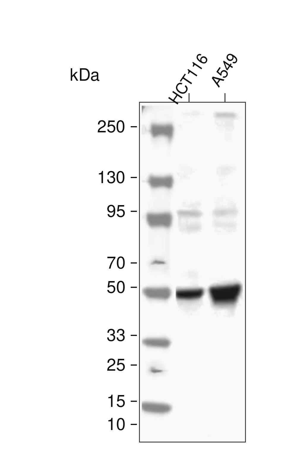 &beta;3 Tubulin Rabbit mAb