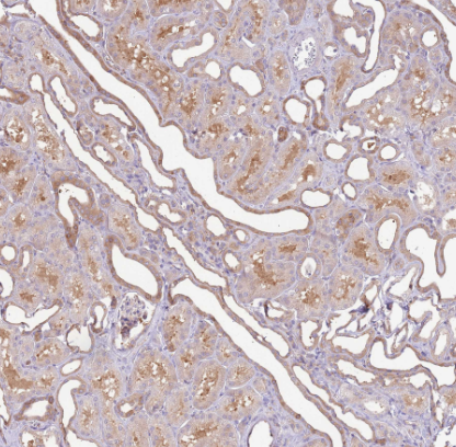 STIP1 Rabbit mAb
