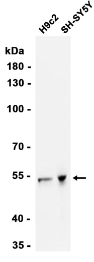 CaMKII beta/ gamma/ delta (Phospho-Thr287) Antibody