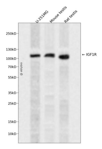 IGF-IR Receptor &beta; Rabbit mAb